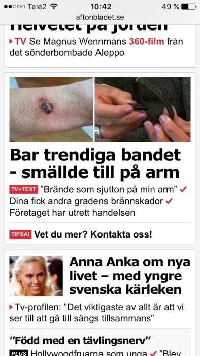 Skärmbild av en artikel på Aftonbladet med bild på en brännskada och nyheter.