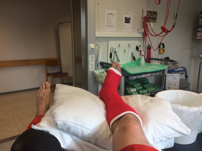 Person med benet i rött gips vilar i sjukhusrum, ironisk referens till sommarpaus.