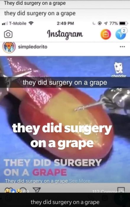 Skärmklipp av flera sociala medieinlägg som upprepar frasen "they did surgery on a grape".