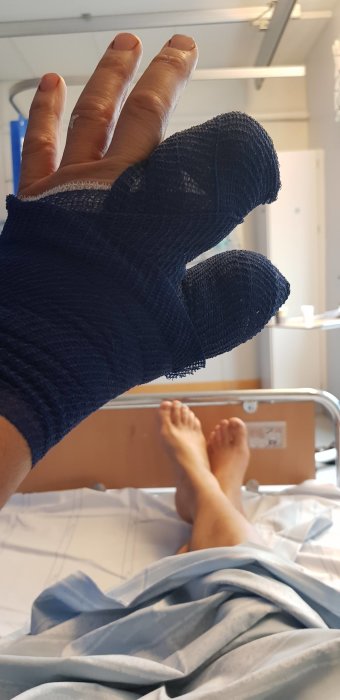 Person med skadat finger i bandage på sjukhussäng, synliga fötter i bakgrunden.