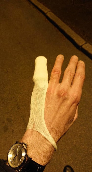 Hand med bandage och klocka efter skada vid användning av Biltemas modellverktyg.