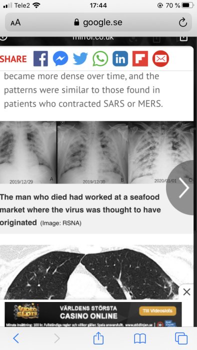 Sekvens av röntgenbilder som visar lungornas förändring över tid hos en patient med COVID-19.