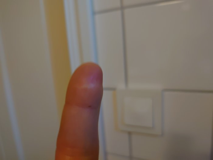 Närbild av ett lätt ärrat vänstra pekfinger som skadats i en sågolycka.