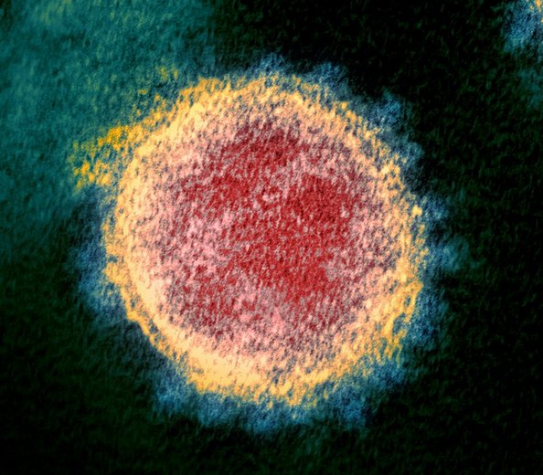 Transmissionselektronmikroskopi-bild av SARS-CoV-2-viruset med färgtillägg; röd kärna omgiven av gul och blå corona.