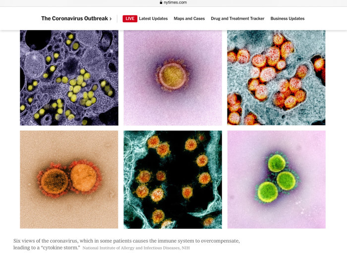 Sex olika mikroskopbilder av coronaviruset SARS-CoV-2 som kan leda till cytokinstorm.