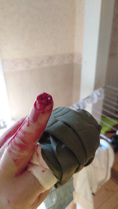 Skadat pekfinger med blod och bandage efter en olycka med en bordssåg.