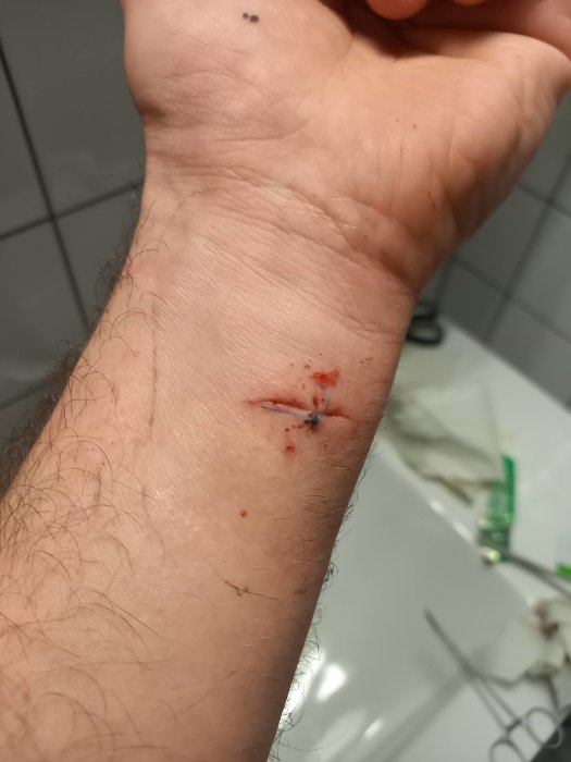 En hand med ett självplacerat enkelt stygn i handleden, blod och suture-kit syns.