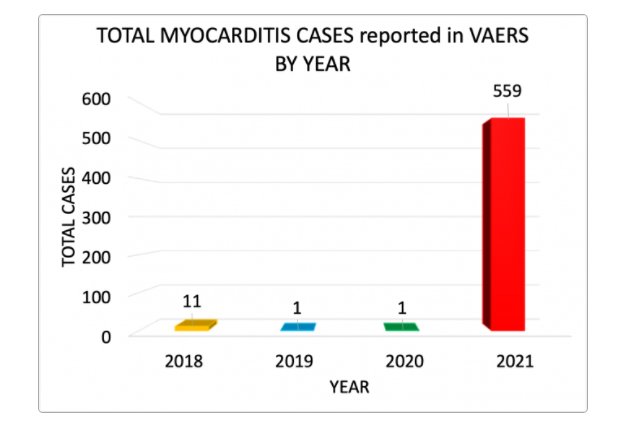 Stapeldiagram som visar antal rapporterade myocarditfall i VAERS från 2018 till 2021, med kraftig ökning 2021.