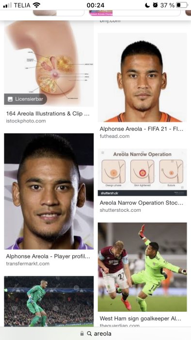 Sökresultatsida med bilder på anatomi och fotbollsspelaren Alphonse Areola i olika kontexter.