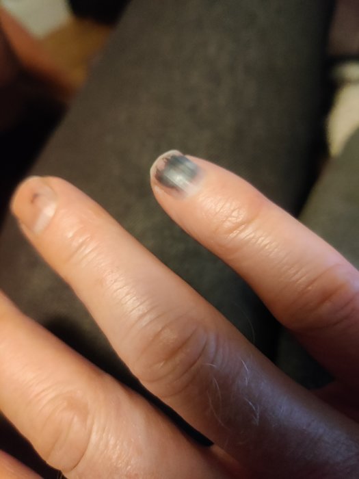 Hand närbild. Fingrar med delvis avskavat nagellack. Sliten manikyr. Bakgrund suddig, interiör antyds.