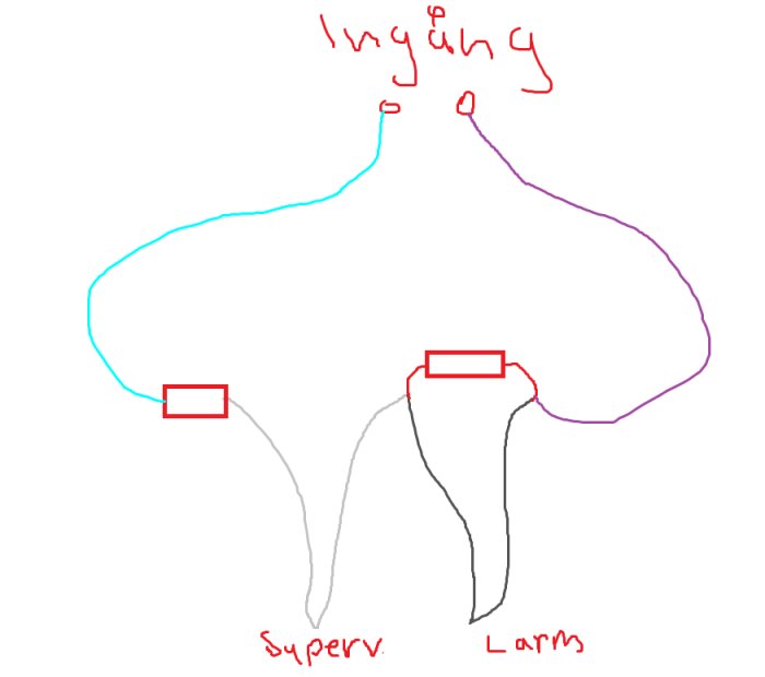 Enkelt ritad anatomisk illustration av en handflata med etiketterade nerver och strukturer, tecknad i olika färger.