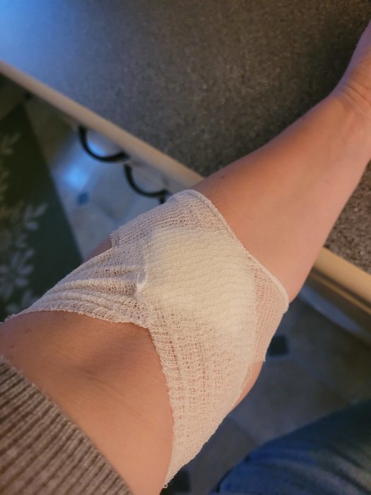 Ett förband runt en handled, inomhus, person klädd med tröja och jeans.