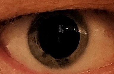 Närbild på ett mänskligt öga, med synlig iris, pupill och ögonvitor.