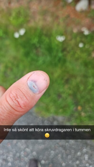 Ett finger med ett blåmärke under nageln, text indikerar olycka med en skruvdragare. Bakgrund är suddig natur.