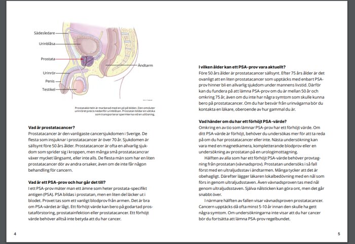 Anatomisk illustration av manligt bäcken med prostata, text om prostatacancer och PSA-test på svenska.