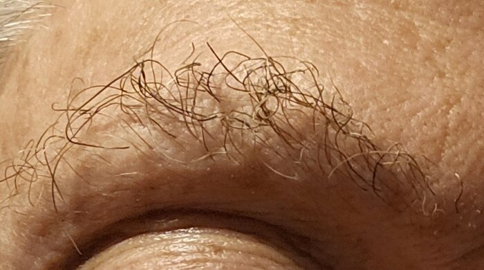 Närbild på en person med lätt svedda ögonbryn efter att ha varit nära en brasa.