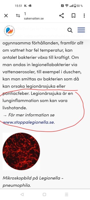 Mikroskopbild av Legionella pneumophila bakterier som kan orsaka legionärssjuka.