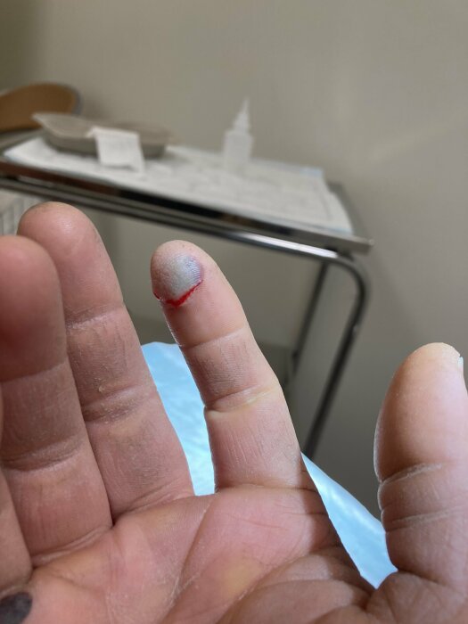 En närbild på en person som visar upp ett bandagerat finger med ett litet blodigt sår.