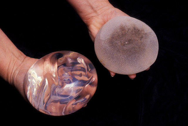 breast-implants-prosthesis-augmentation-antalya-turkey.jpg