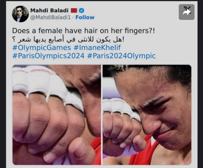 Kvinna med tejpade händer och ansikte som visar en bekymrad eller tänkande min, med text och hashtags om OS och Paris 2024.