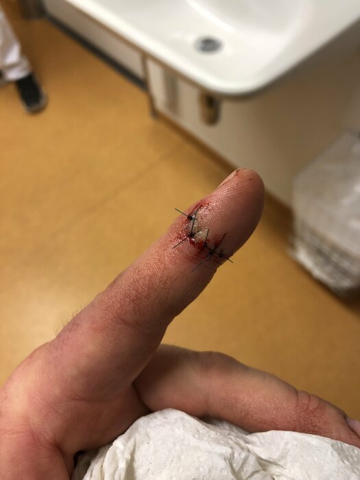 Skadat finger med stygn, vältat mot badrumsgolv, efter att ha skurit sig på en kniv.