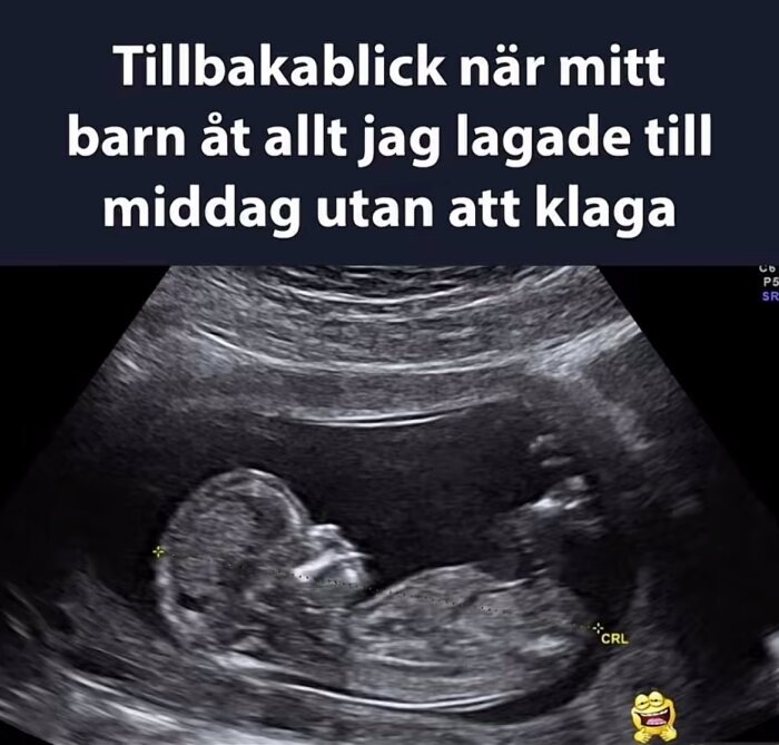 Ultraljudsbild av ett foster, med humoristisk text om när barnet åt allt under graviditeten utan att klaga.