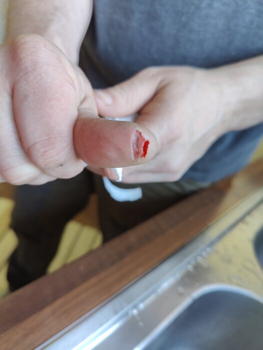 Skadad tumme med skärsår efter en olycka med klyvsåg, person håller upp tummen över vask.