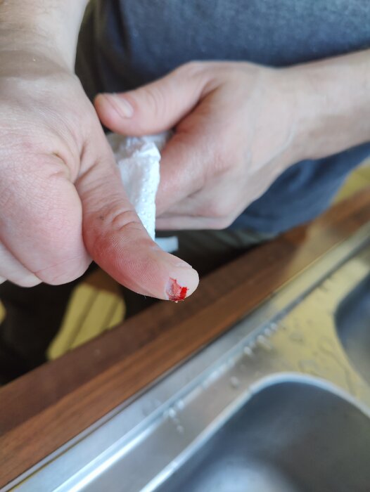 Blödande tumskada efter kontakt med klyvsåg, finger nära diskbänk.