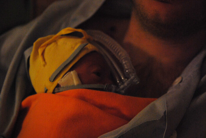 Nyfödd bebis med gul mössa och andningsmask, insvept i en filt i en vuxens famn.