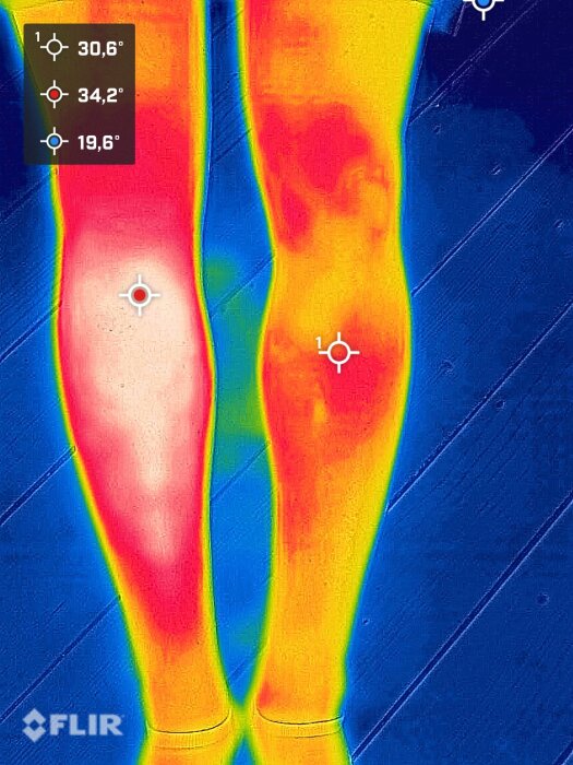 Termografibild av ben som visar inflammation med temperaturvariationer efter djurbett.