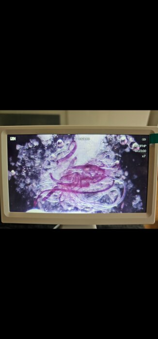 Närbild av en liten organism under mikroskop, visas på en skärm.