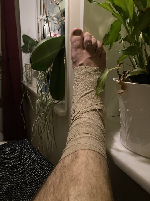 Ett ben med en inlindad fot vilar upphöjt på en yta, omgiven av gröna växter i krukor.