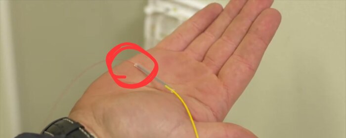 Hand som håller en kapad fiberkabel med ett rödmärkt område för att visa skadan.