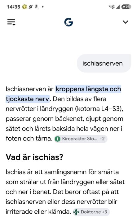 Ischiasnerven förklaring med text, lyft stycke om kroppens längsta och tjockaste nerv. Text om smärta från ländryggen ner i benet.